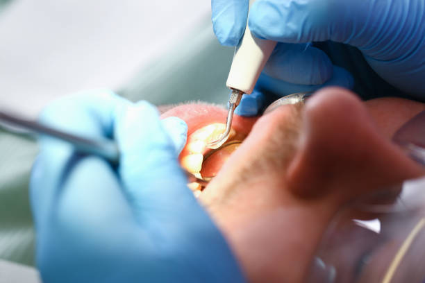 Best Emergency Dentist for Knocked-Out Tooth in Lansdale, PA